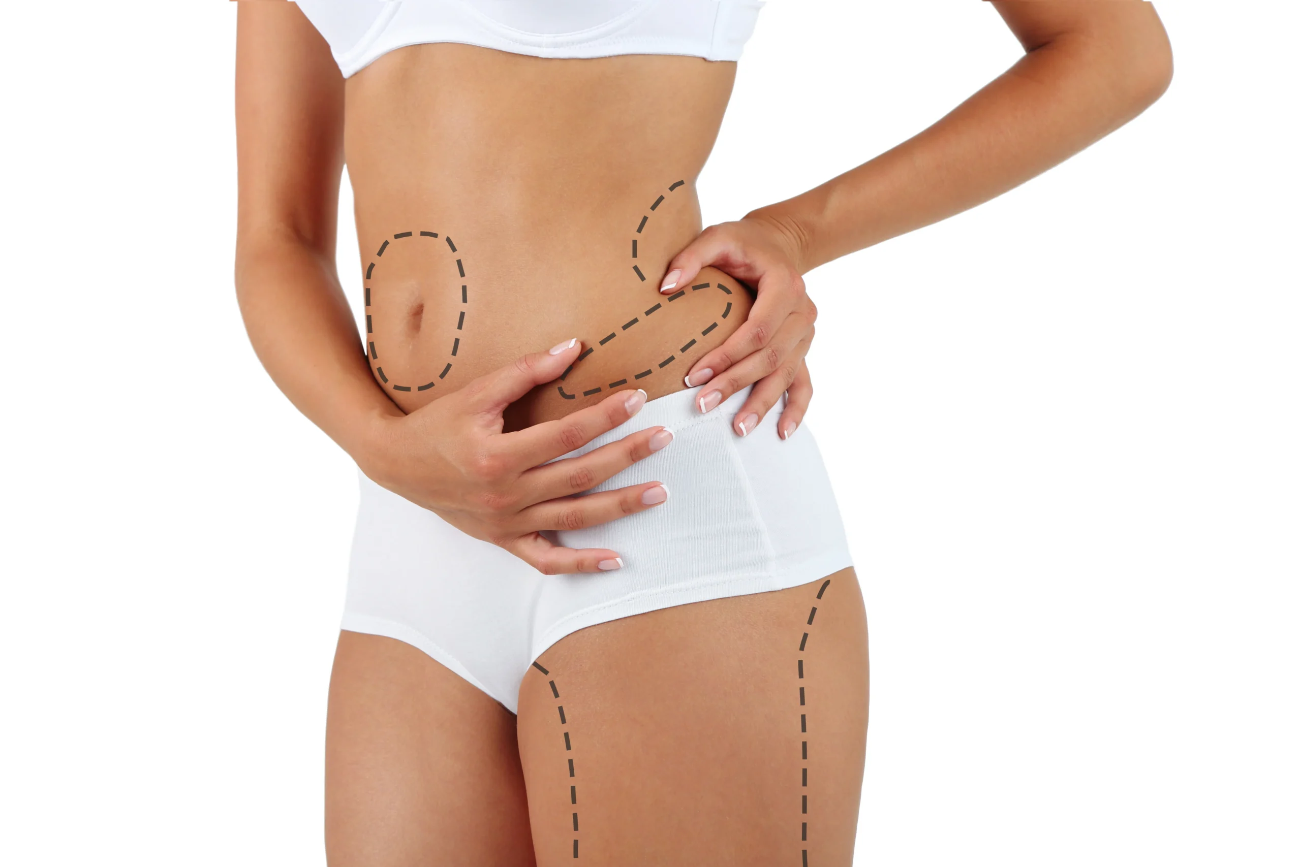 Antalya liposuction